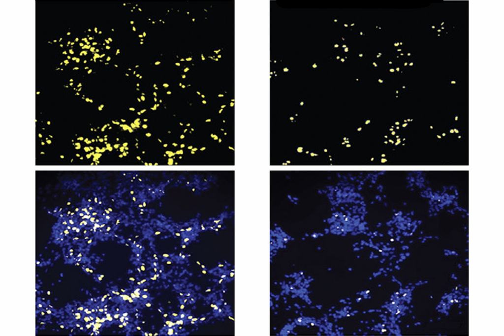 Research image of neural progenitor cells.
