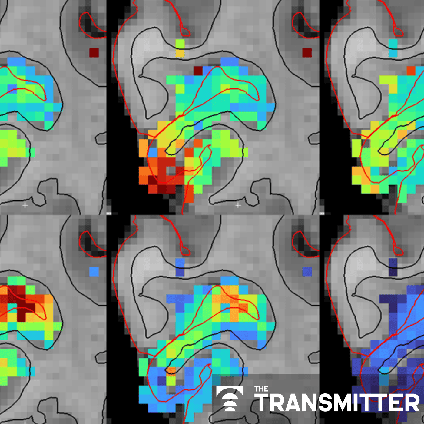 Functional MRI can do more than you think episode artwork