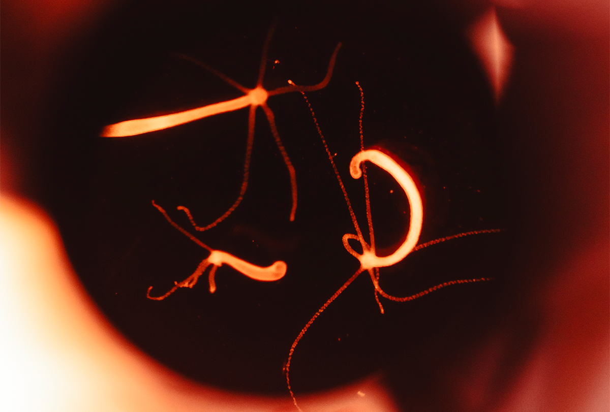 Hydra under a microscope in the Yuste lab.