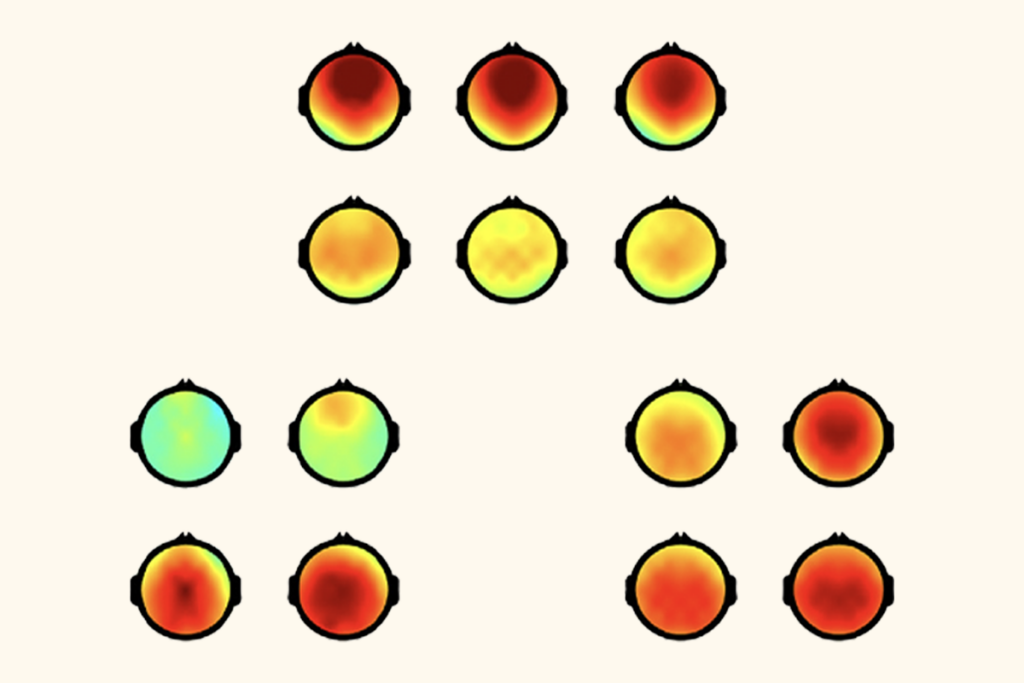 Research image of EEG scans showing dopamine levels in human brains.