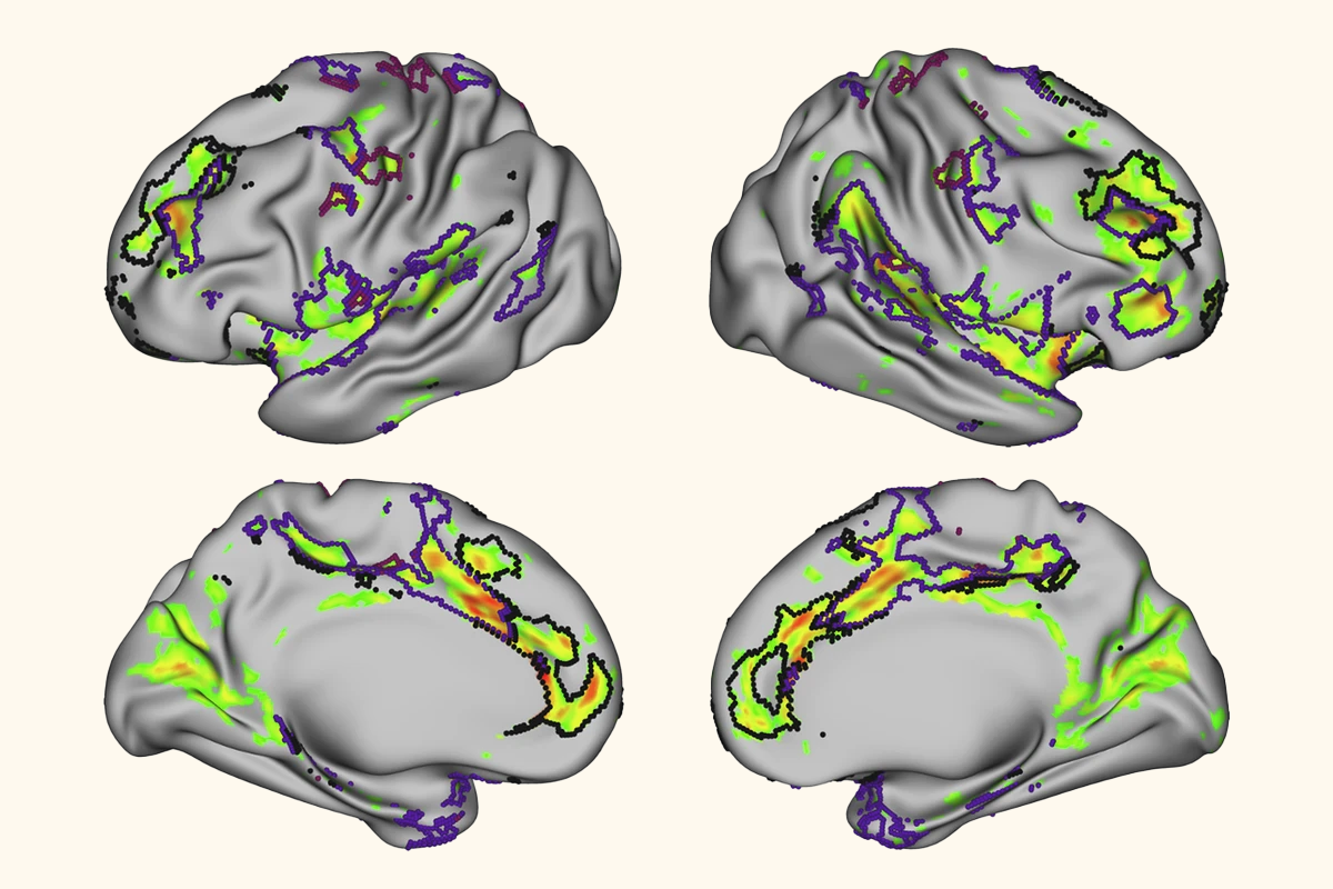 Research image showing resting-state functional connectivity in the human red nucleus.