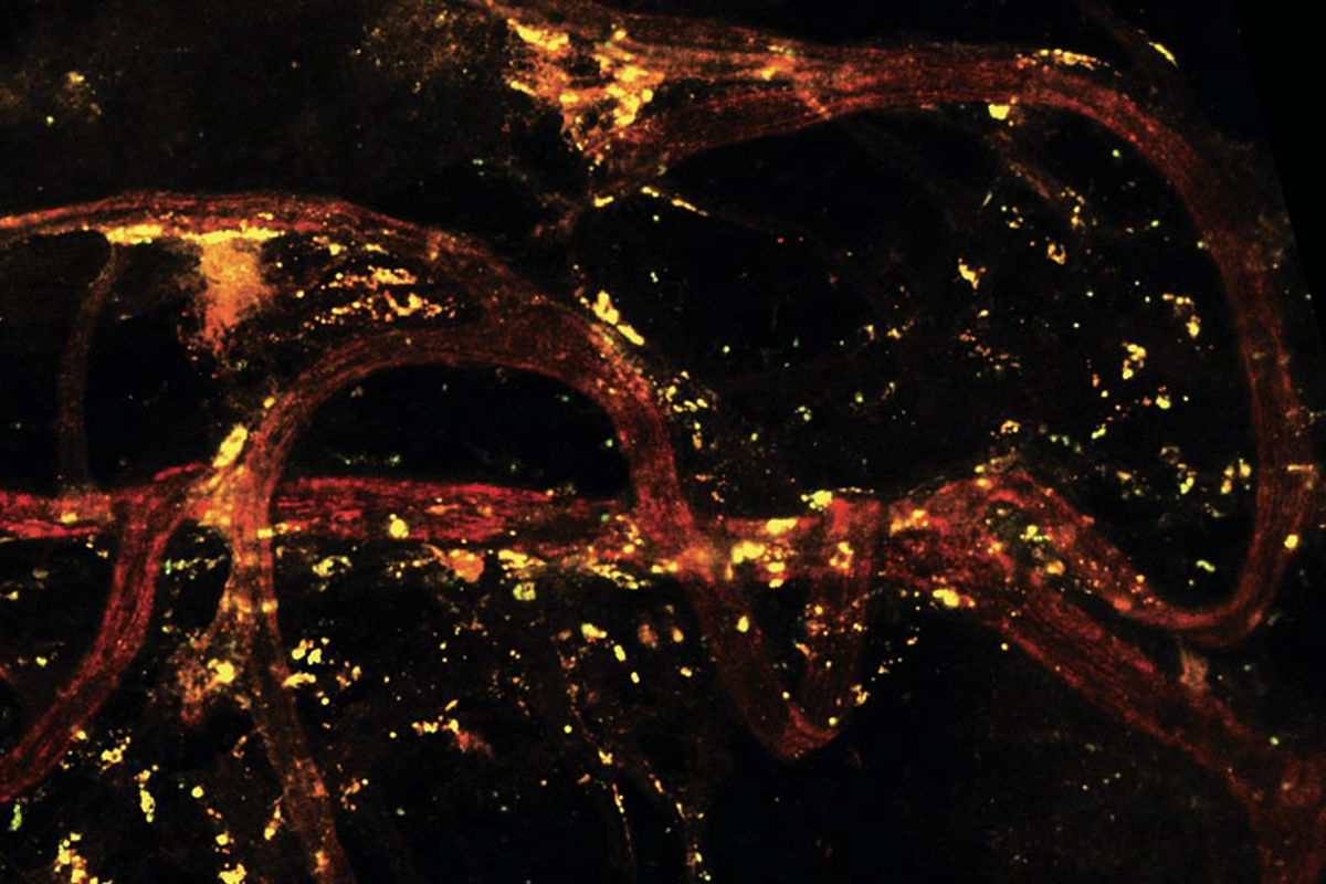 Research image of the spinal meninges in mice.