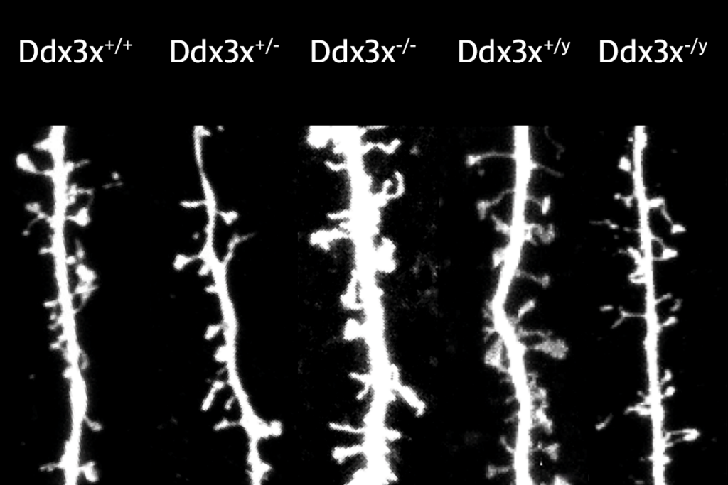 Research image of spine formation in mouse neurons.