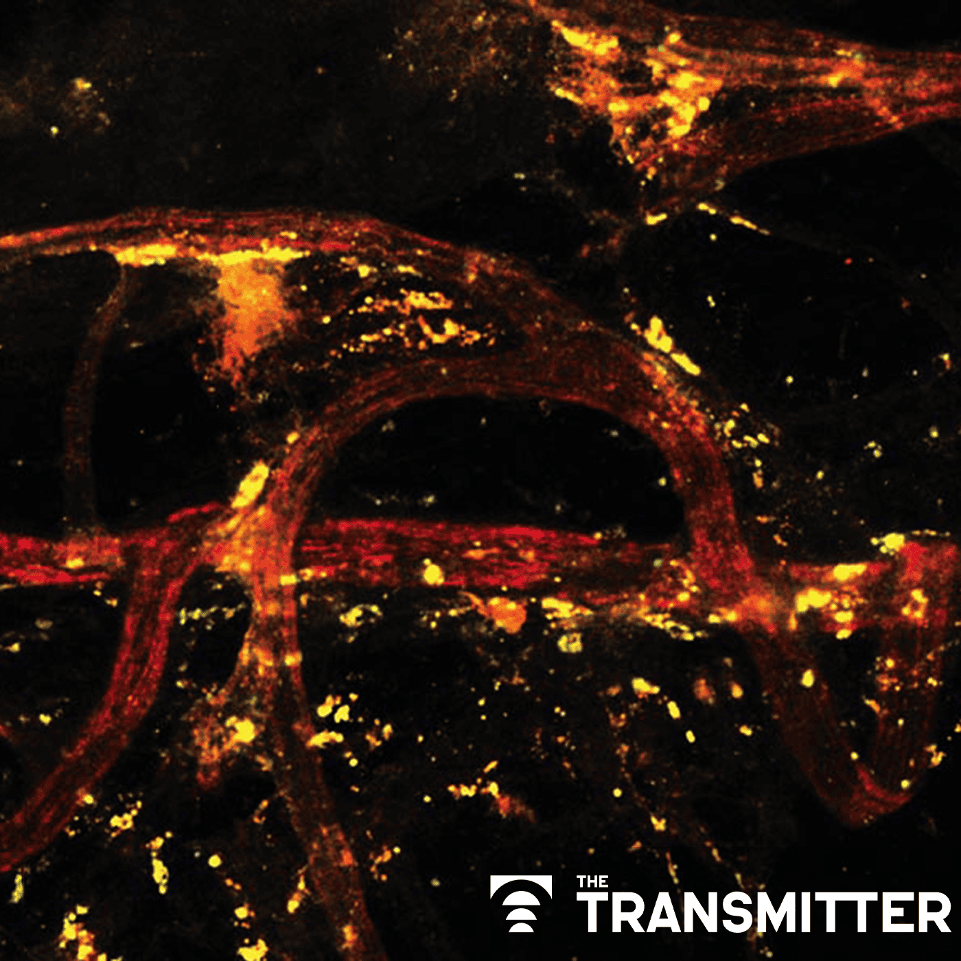 Immune cells block pain in female mice only episode artwork