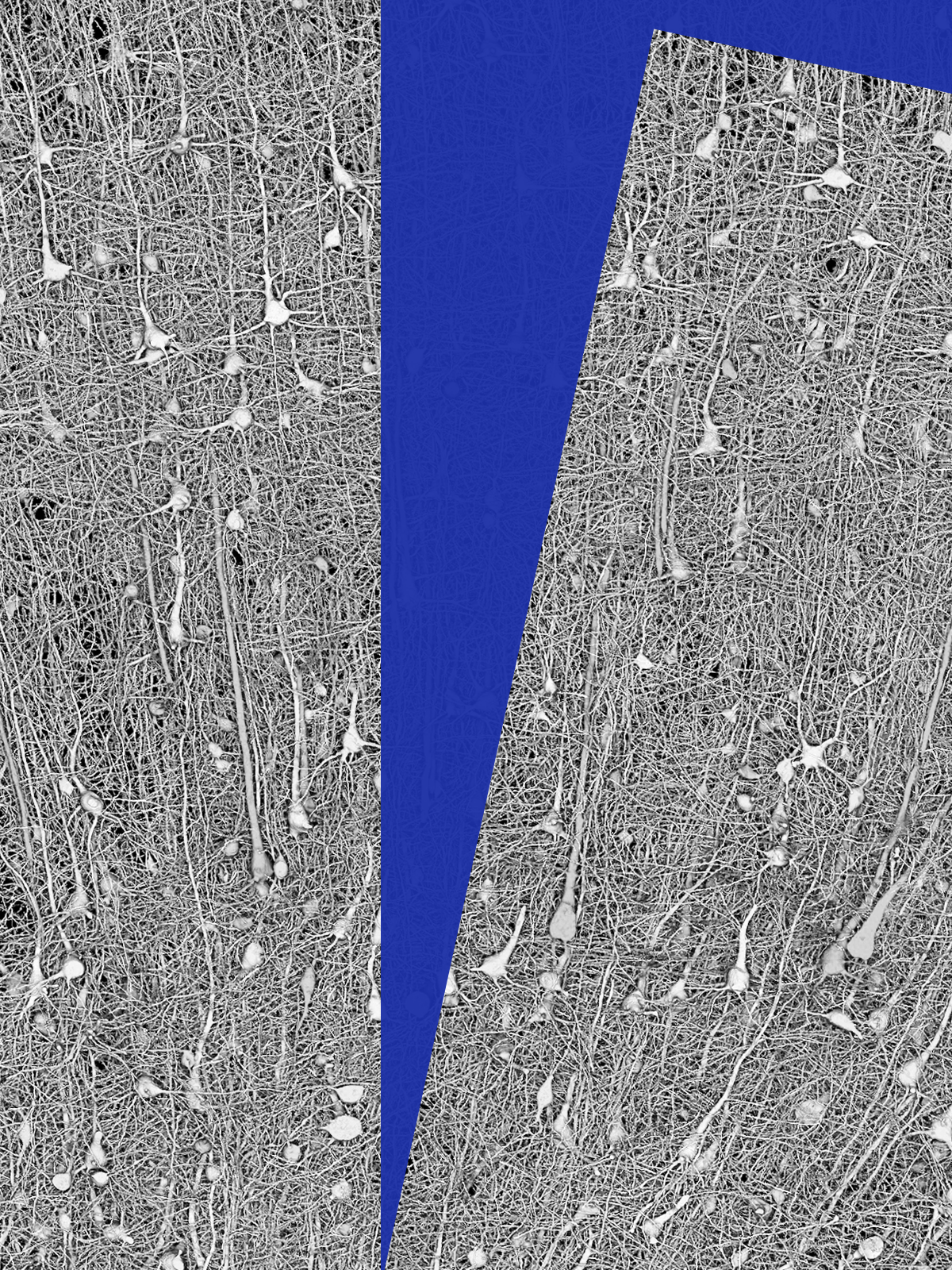 Image of a connectome being split into two.