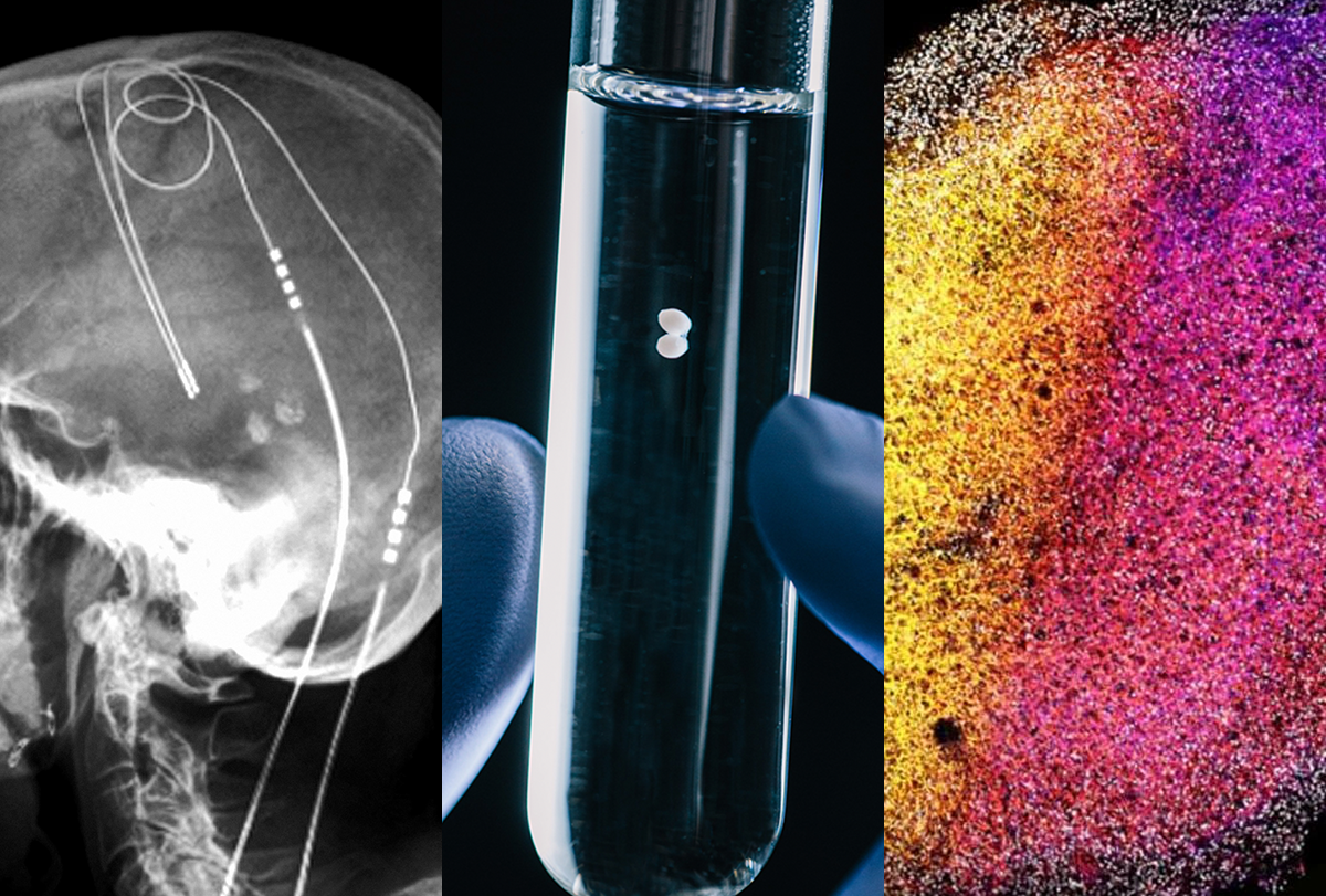 Composite image of a brain probe, a test tube and a brain scan.