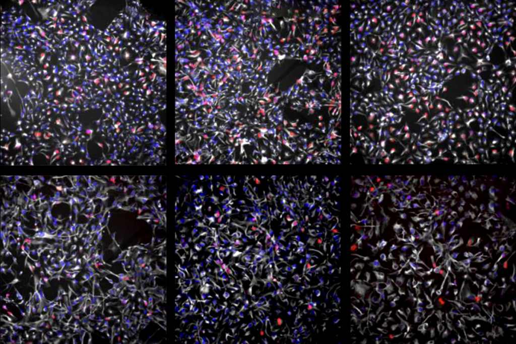 Research image of neural pluripotent stem cells.