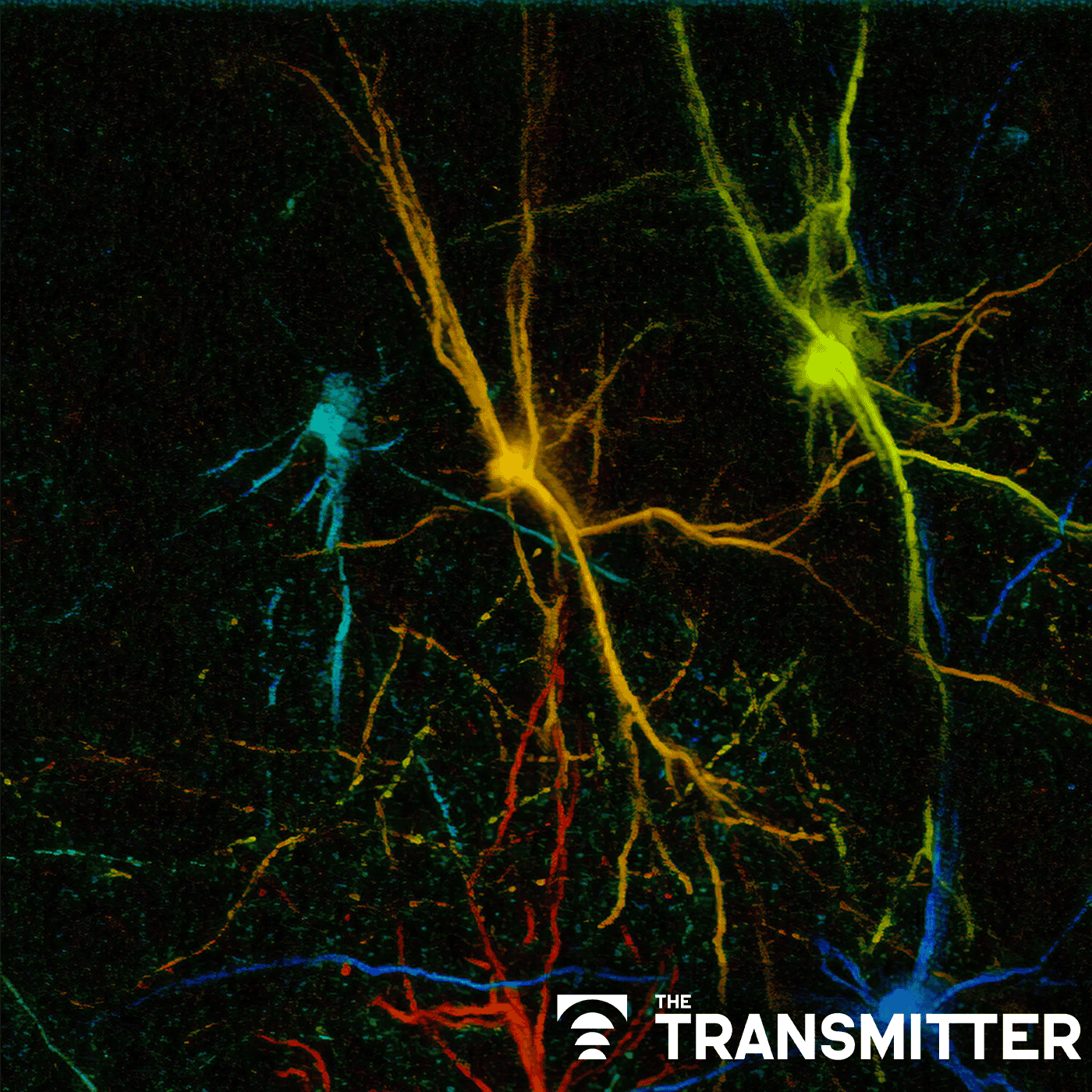 In vivo veritas: Xenotransplantation can help us study the development and function of human neurons in a living brain episode artwork