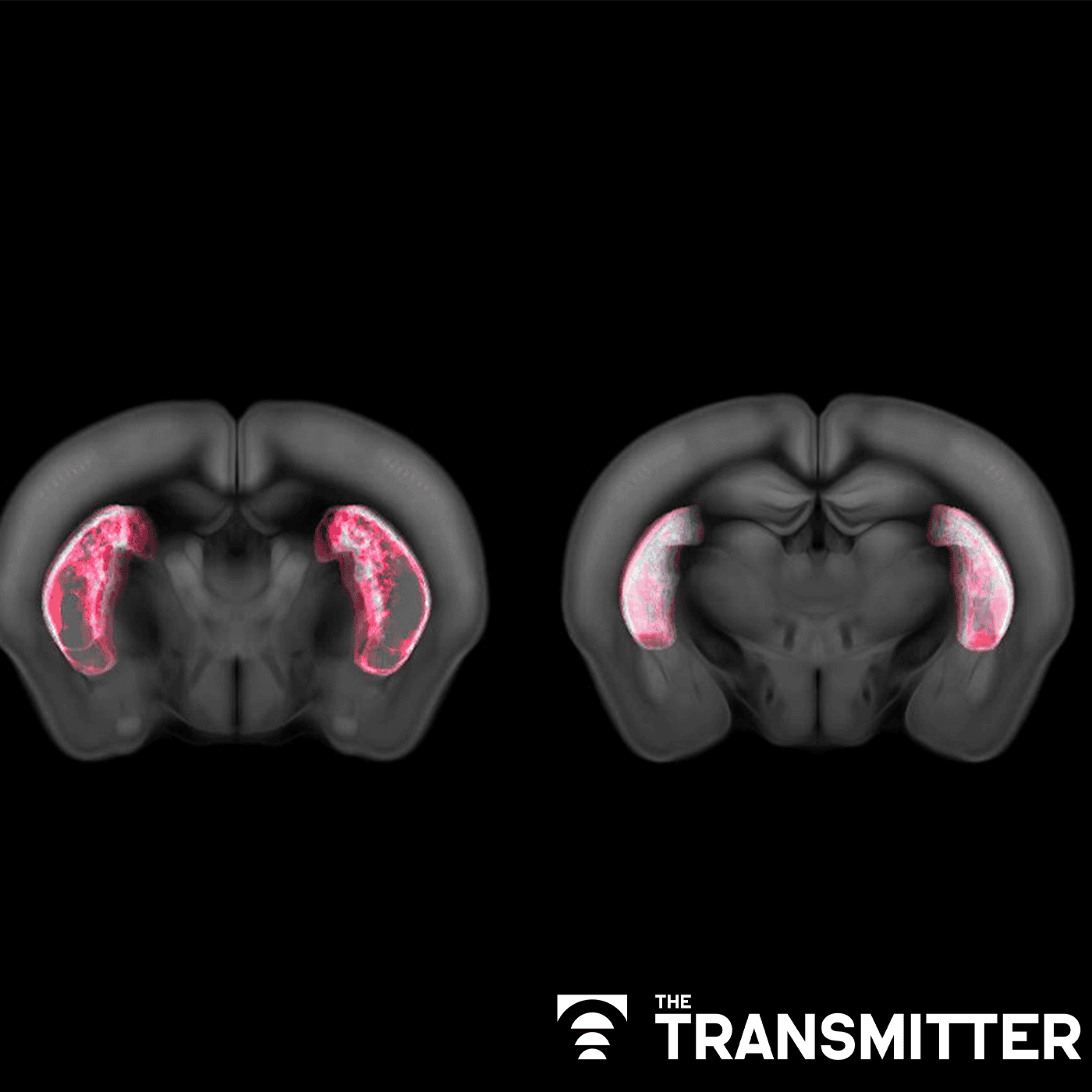 Some dopamine neurons signal default behaviors to reinforce habits episode artwork