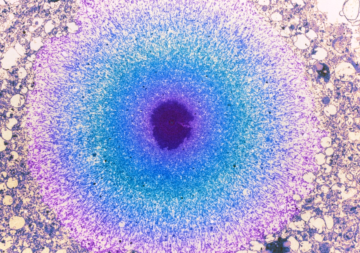 Image of alpha-synuclein filaments in the brain.
