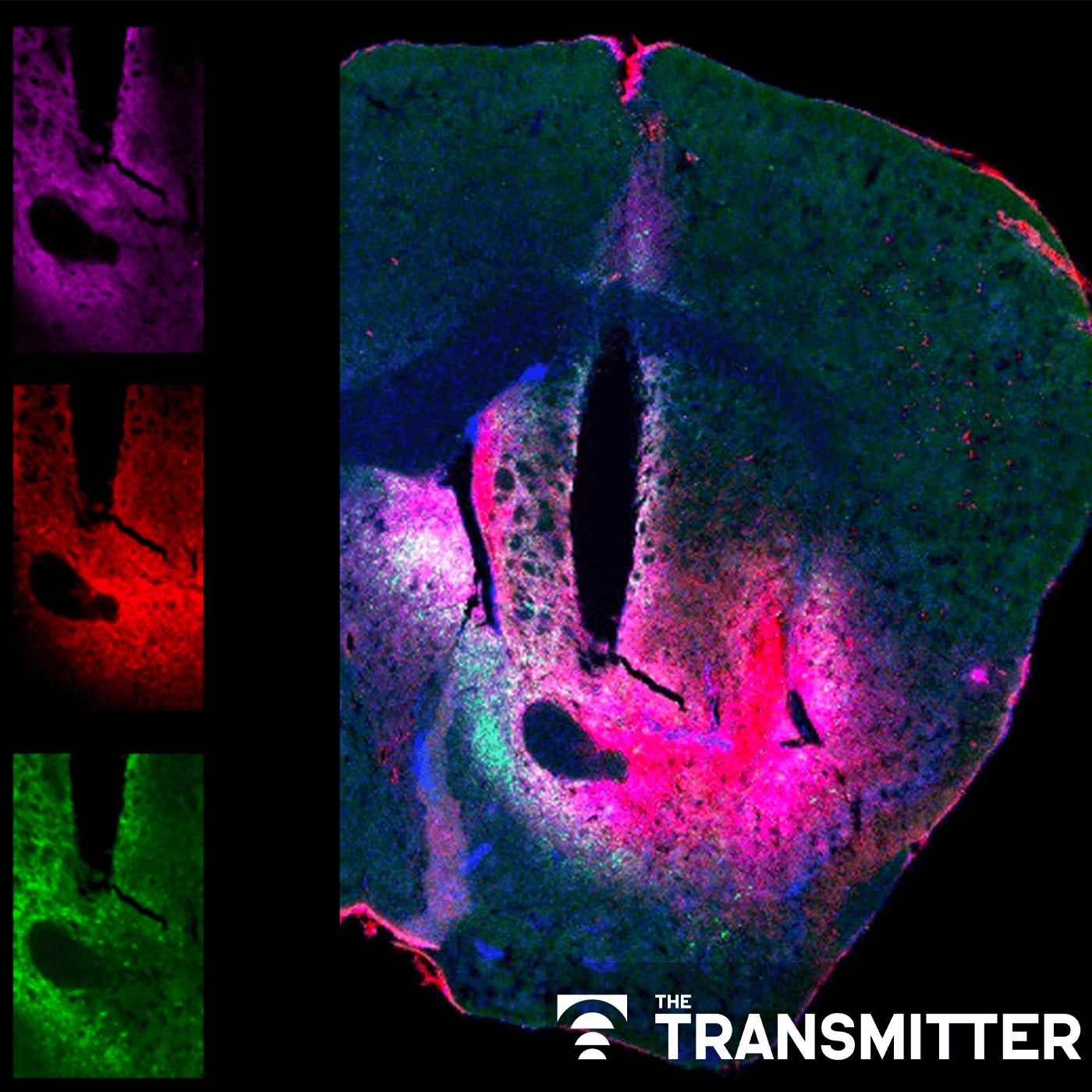 New dopamine sensor powers three-color imaging in live animals episode artwork
