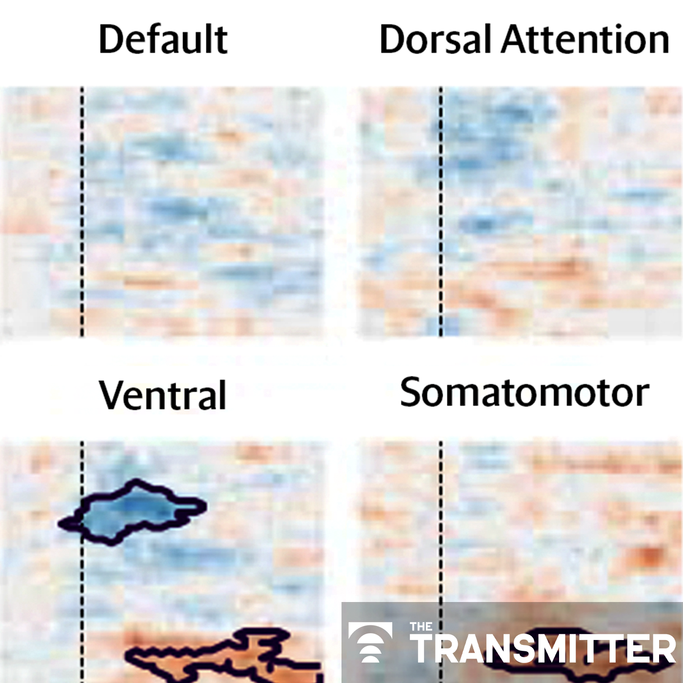 Eye puffs prompt separable sensory, affective brain responses in mice, people