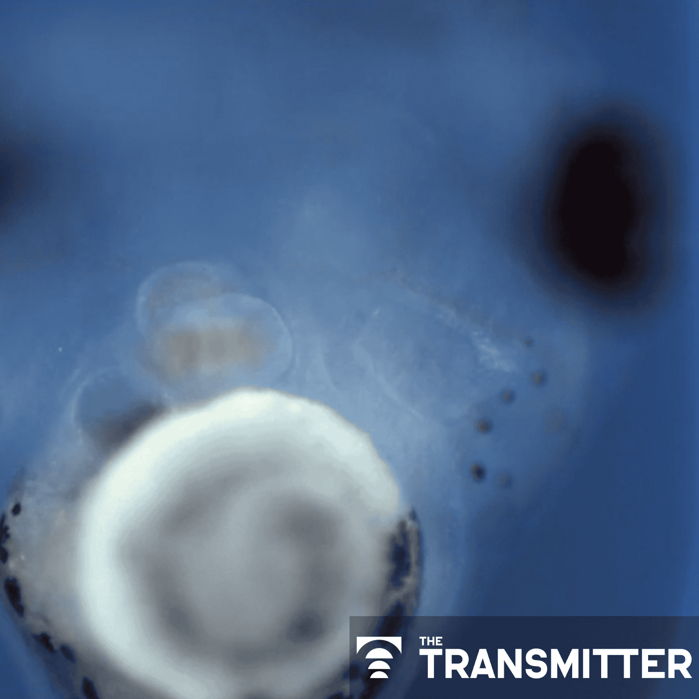 Cell 'antennae' link autism, congenital heart disease episode artwork