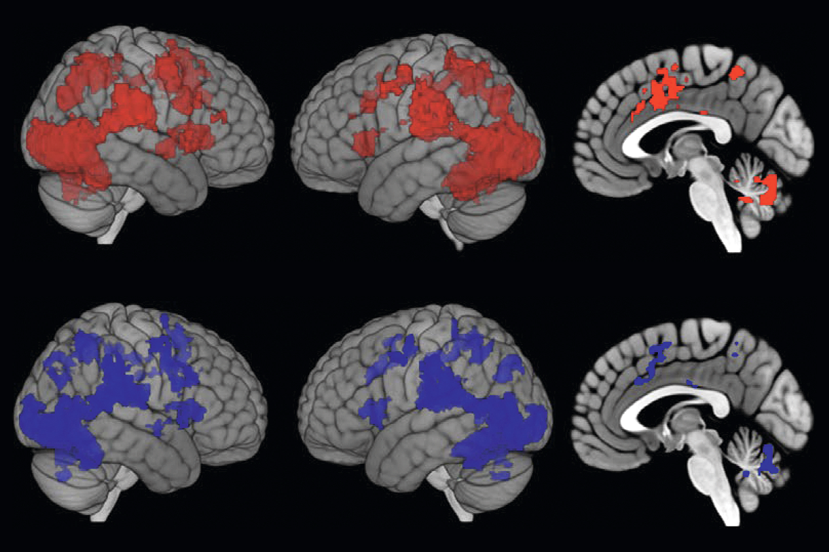 Brain scans showing activity in areas associated with threat detection and peripersonal space.
