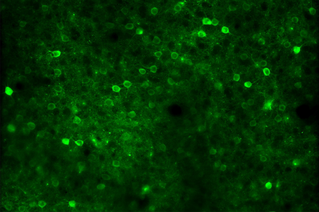 Research image of mouse visual cortex neurons.