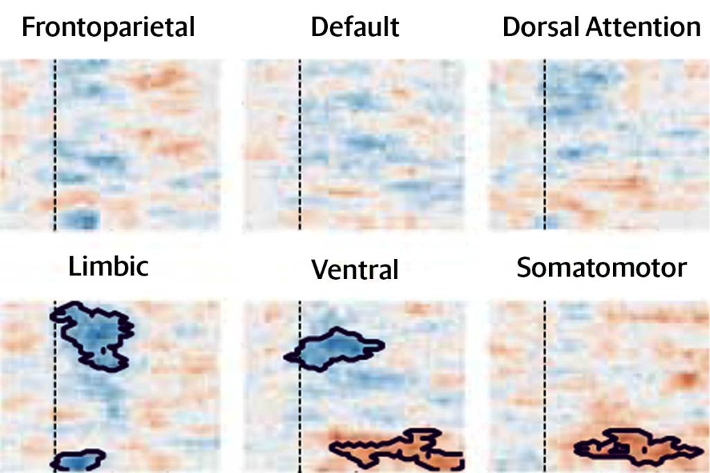Research visualization of reverberating activity in a selection of higher-order brain areas.
