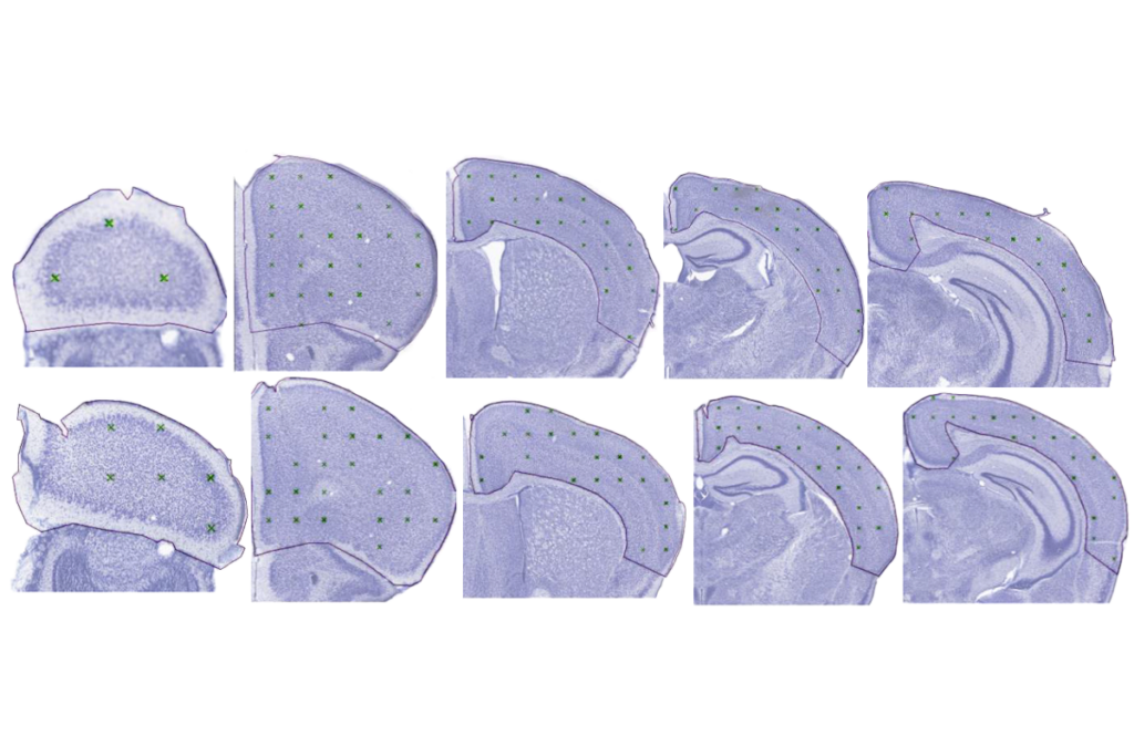 Research image of mouse brain slices.