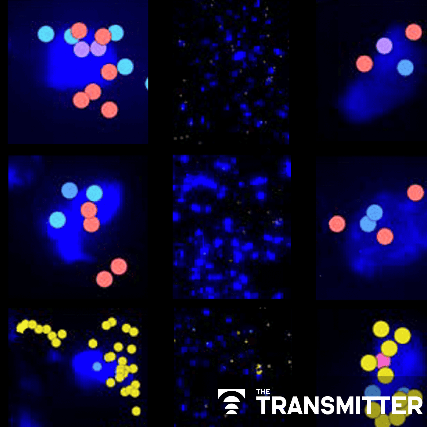 Machine learning spots neural progenitors in adult human brains episode artwork