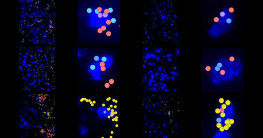 Machine Learning Identifies Neural Progenitors in Adult Human Brains