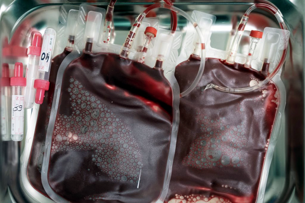 Bag of umbilical cord blood.