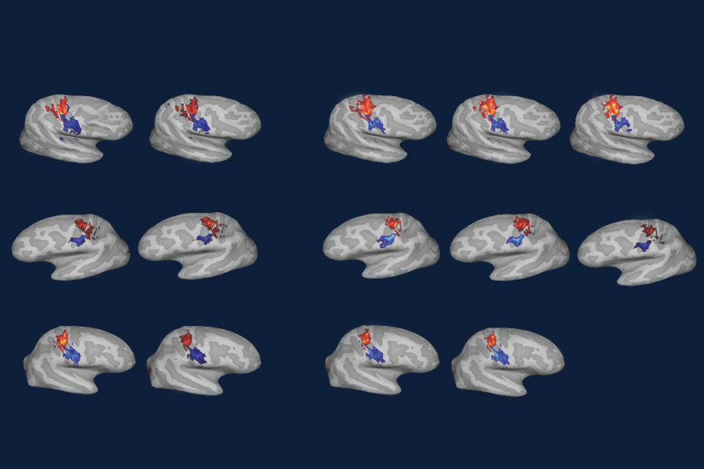 Research image of cortical maps of somatosensation.