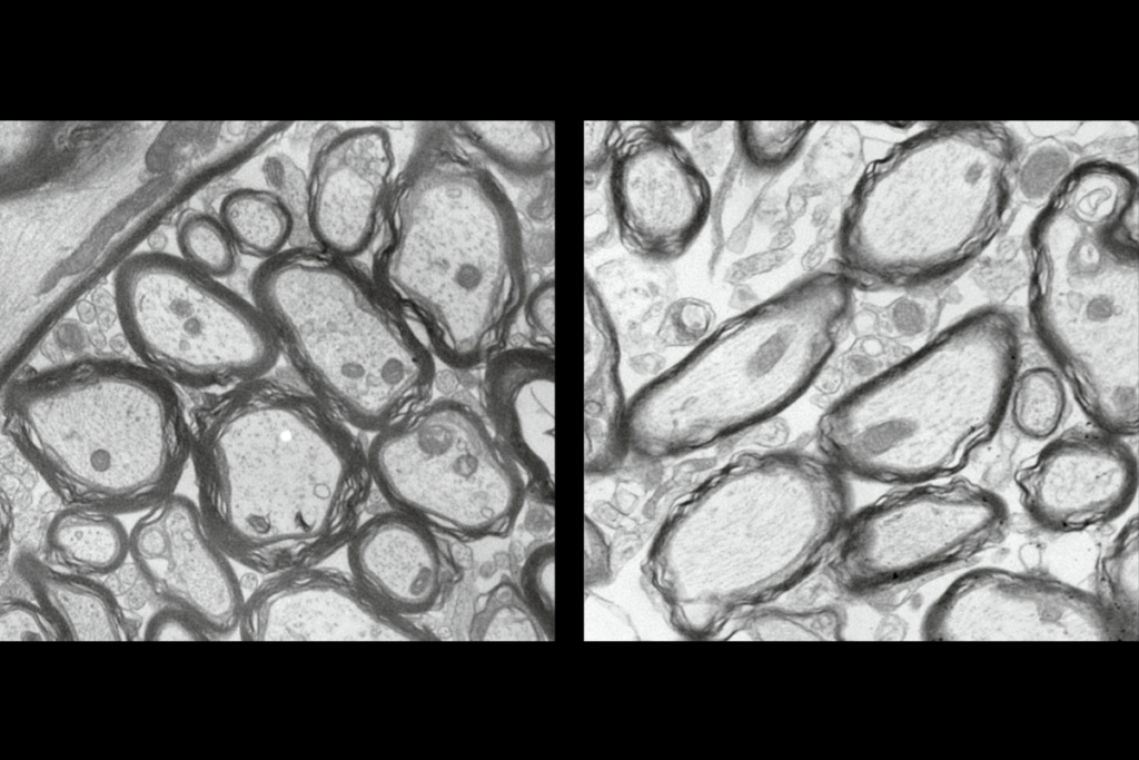 Research image of mouse auditory brainstems.