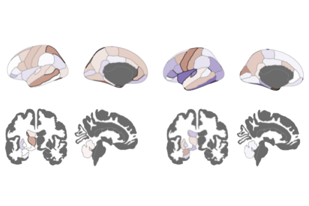 Research image of asymmetry in different brain hemispheres.