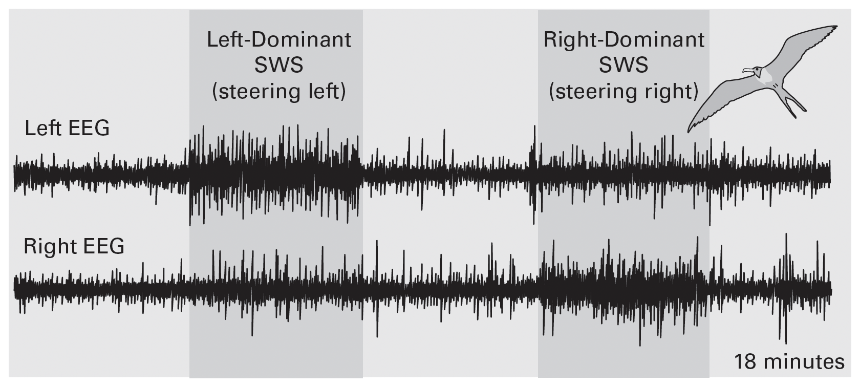 Research image of asymmetric EEG data.