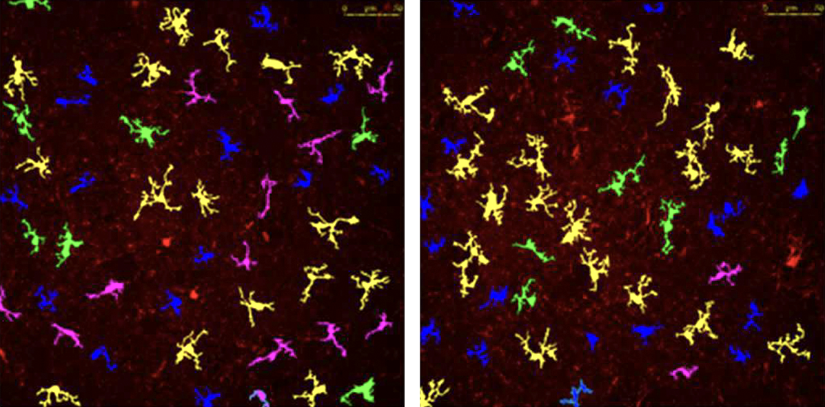 Research image of different types of microglia in mice.