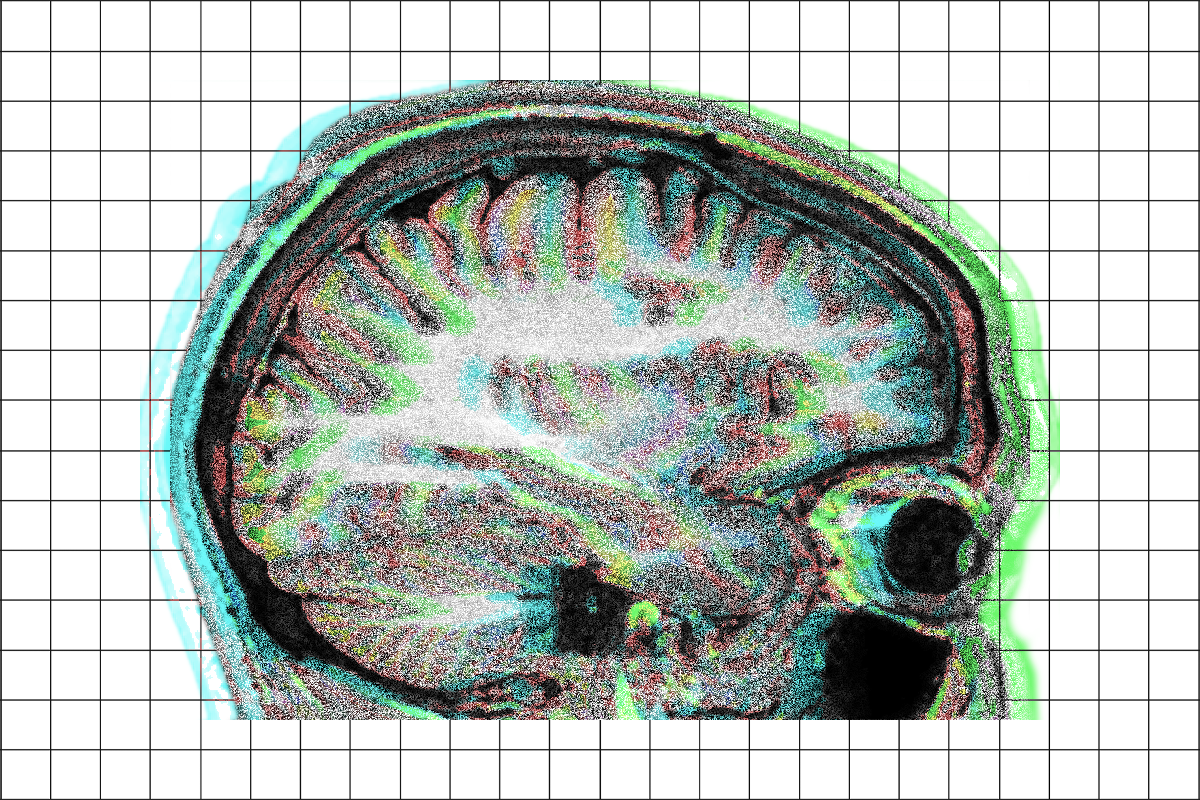 Brain scan with visual noise and glitch effects.