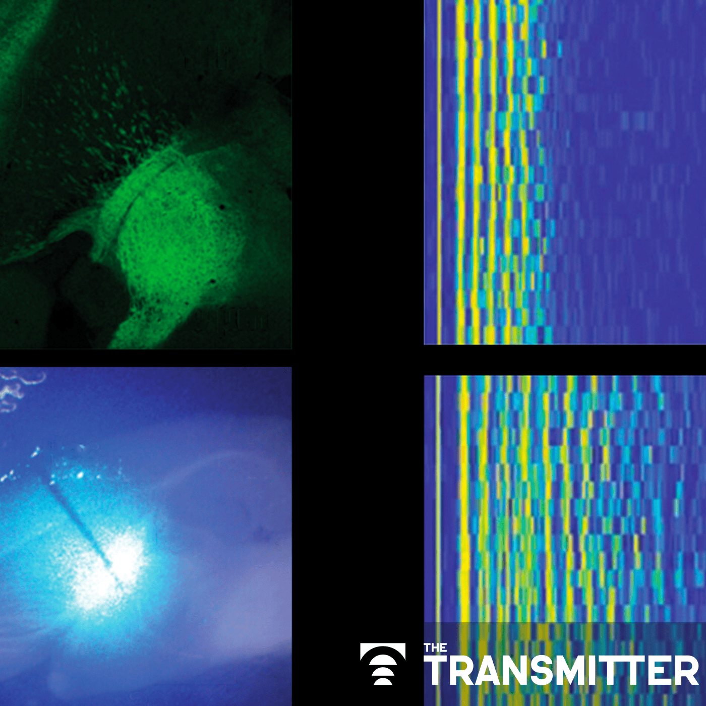 Sensory gatekeeper drives seizures, autism-like behaviors in mouse model episode artwork