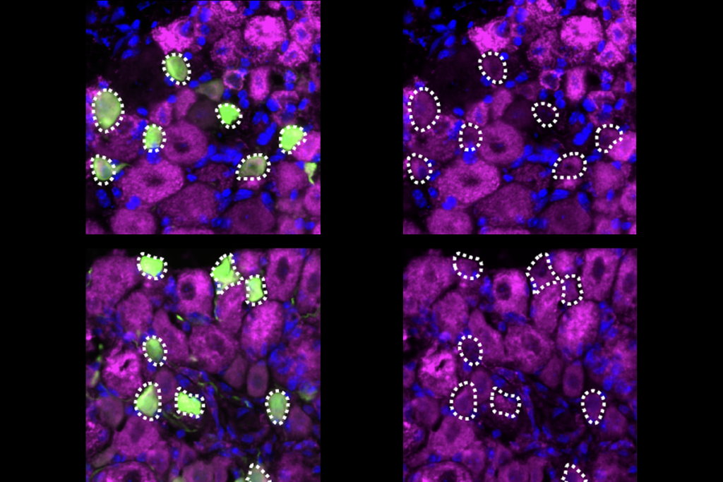 Mouse sensory neurons express the ion channel TPRV1 .