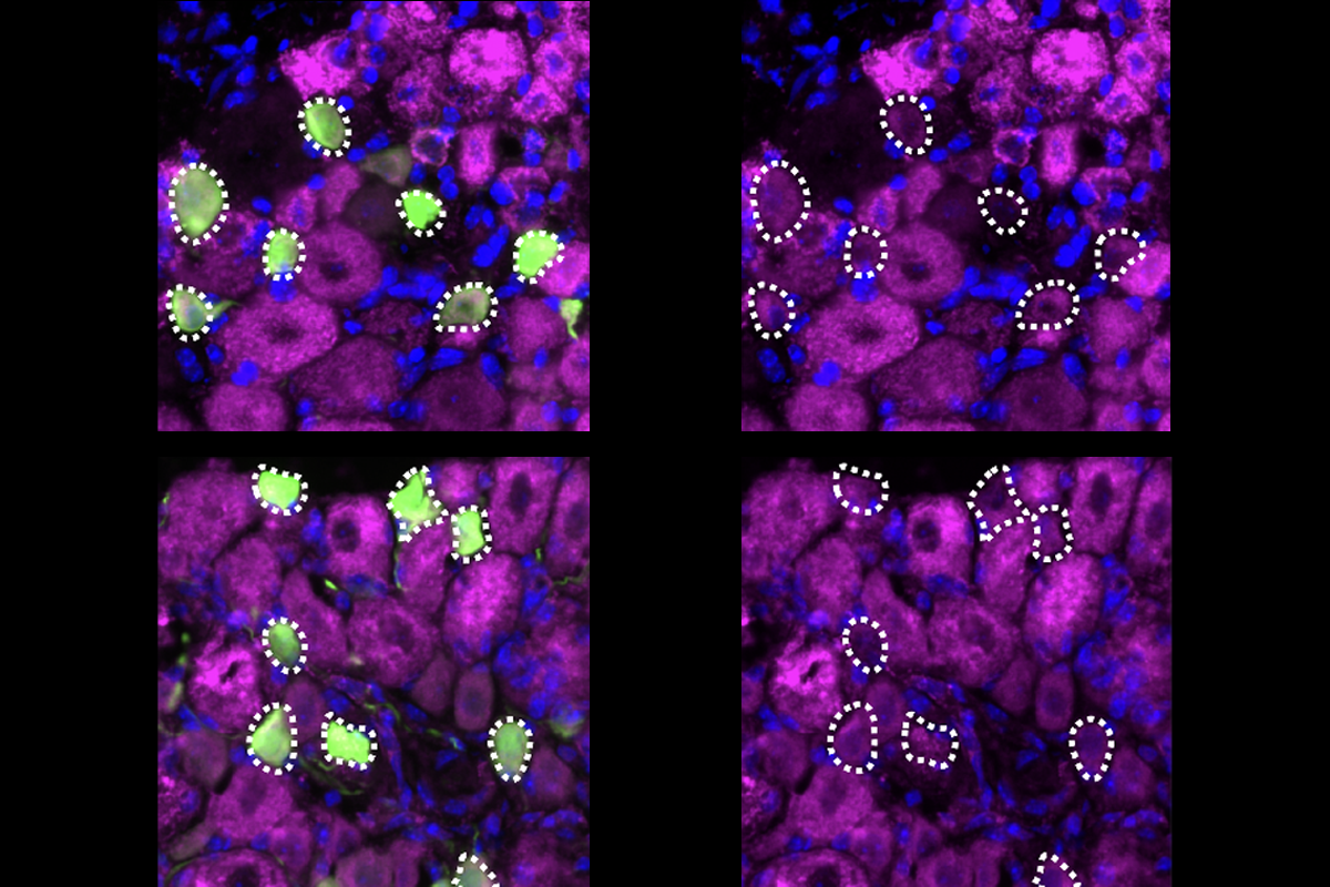 Mouse sensory neurons express the ion channel TPRV1 .