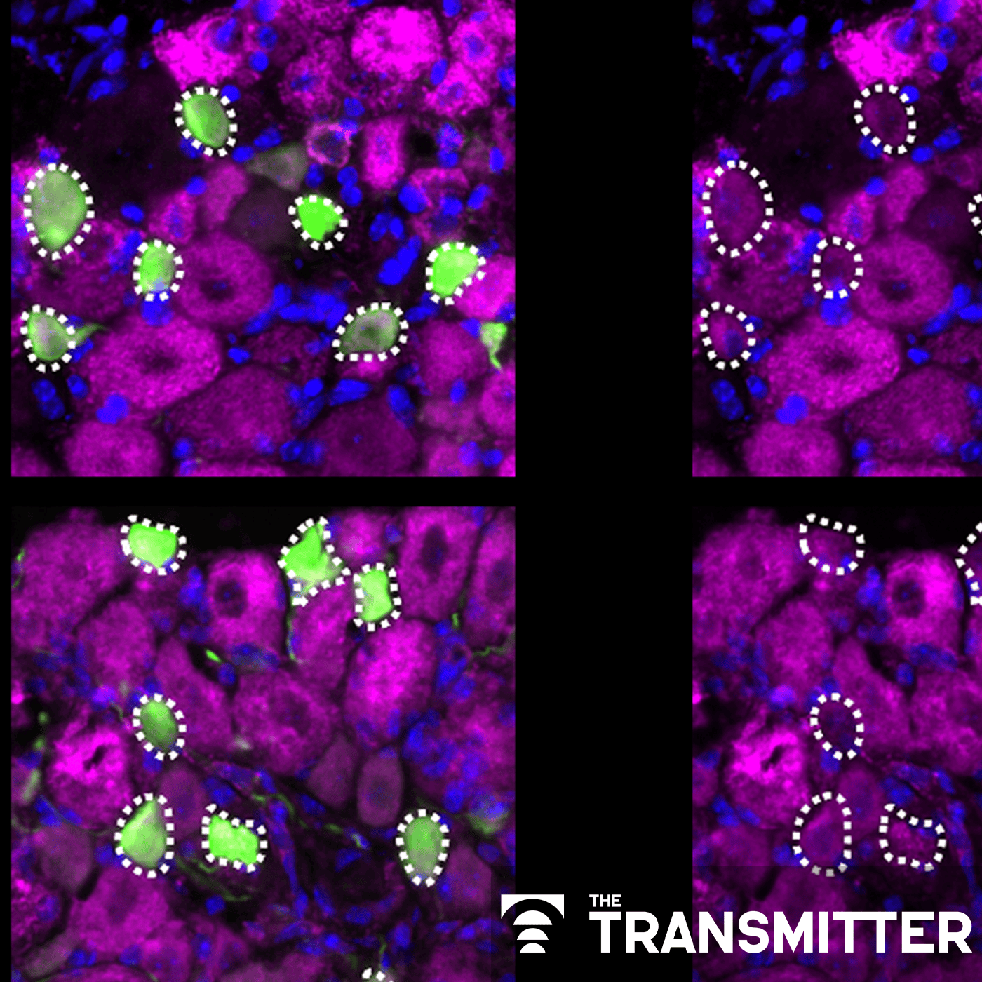 Neurons tune electron transport chain to survive onslaught of noxious stimuli episode artwork