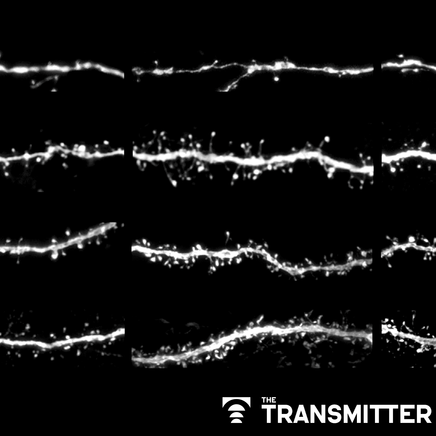 Protein tug-of-war controls pace of synaptic development, sets human brains apart episode artwork