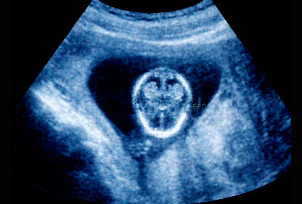Developing human fetus.