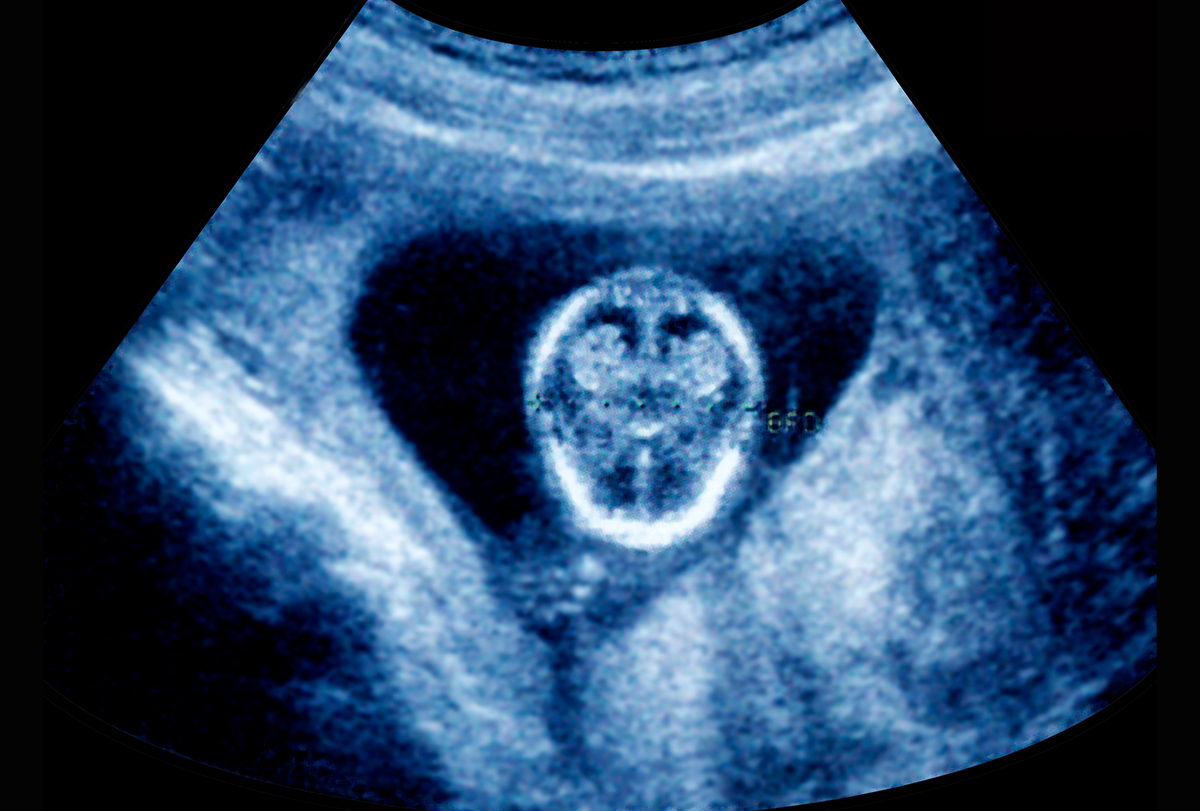 Developing human fetus.