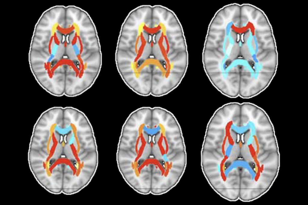 Human brain cross-sections.