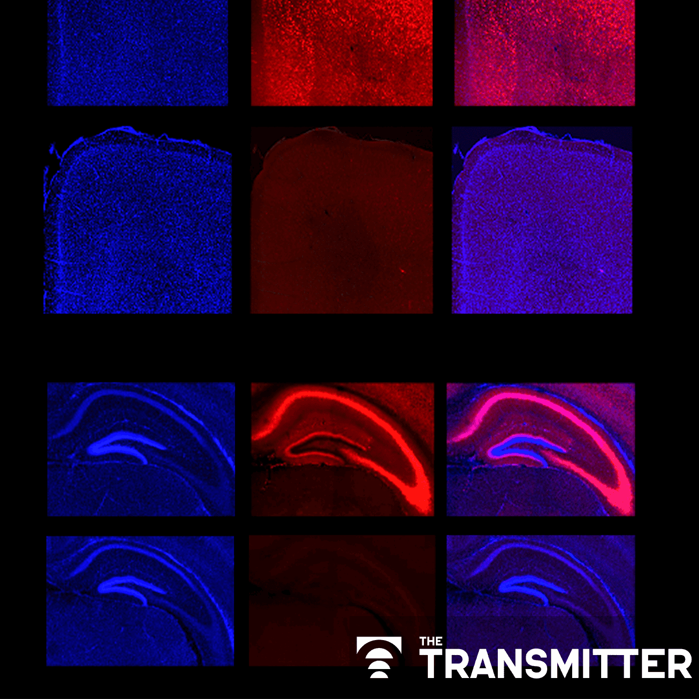 Ramping up cortical activity in early life sparks autism-like behaviors in mice episode artwork