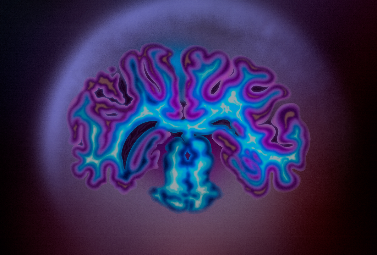 A monkey brain slice.