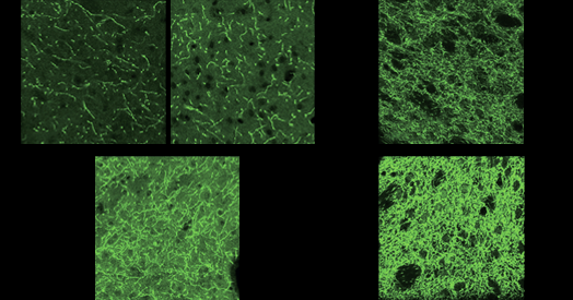 Estrogen effects on female rat learning