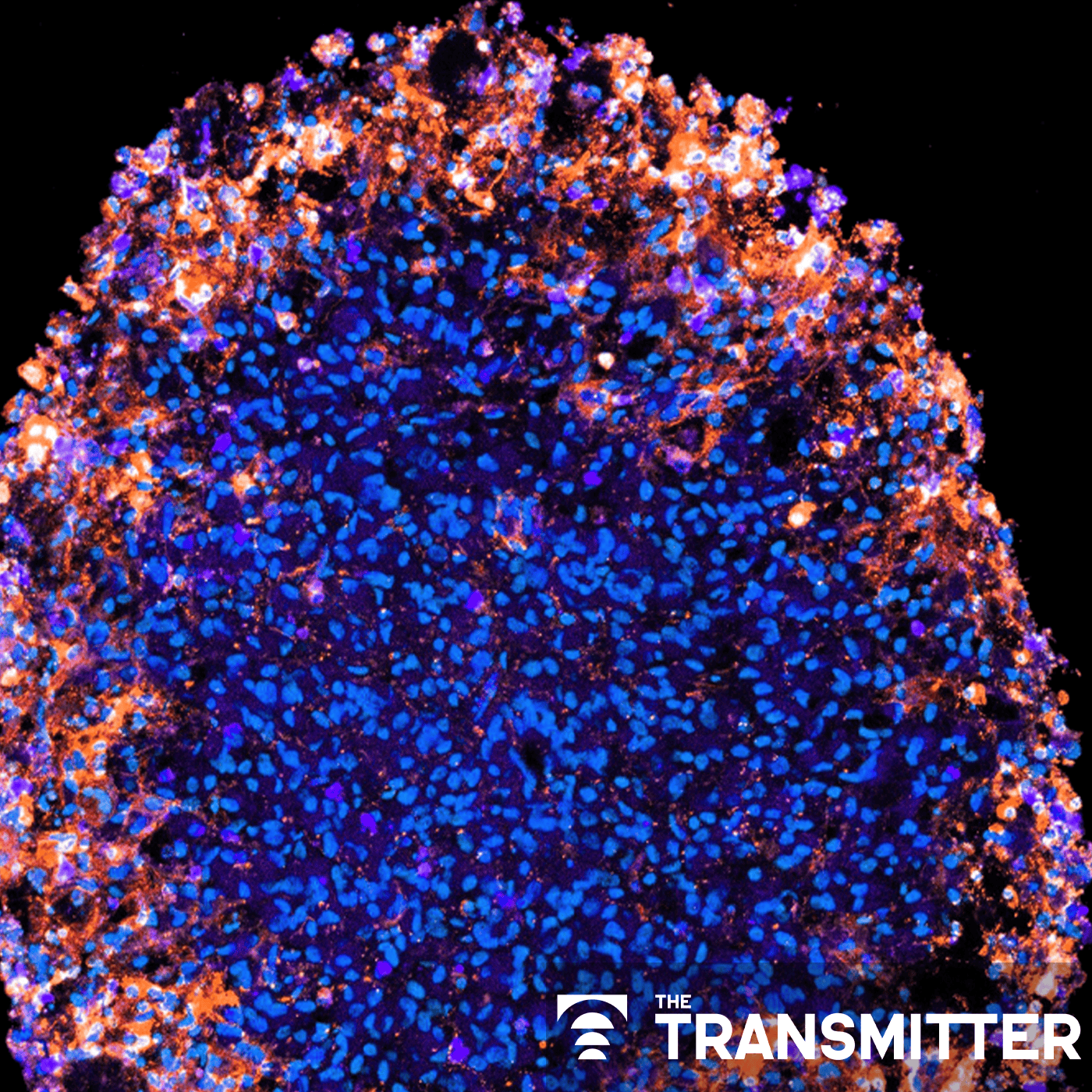 What is the future of organoid and assembloid regulation? episode artwork