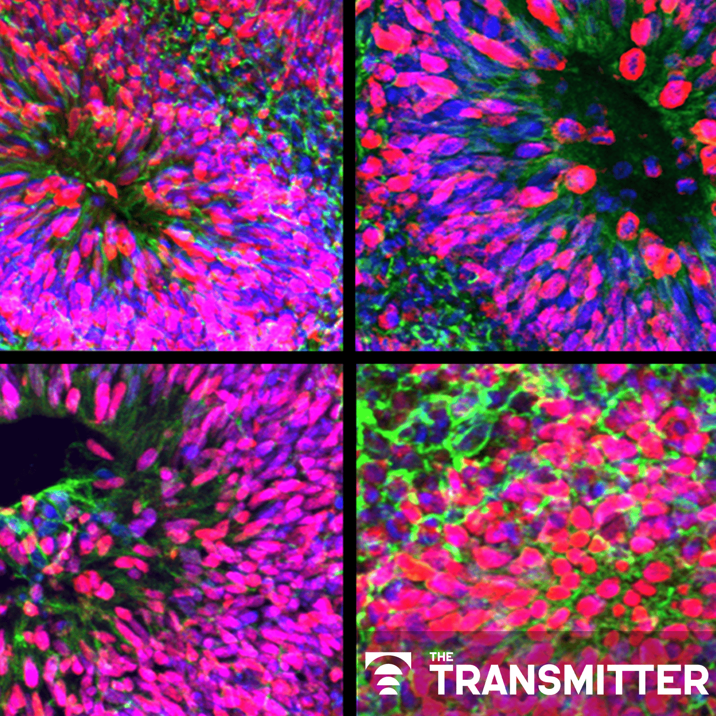 New organoid atlas unveils four neurodevelopmental signatures episode artwork