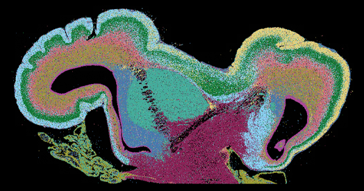 cropped-525-16p112-striatum-