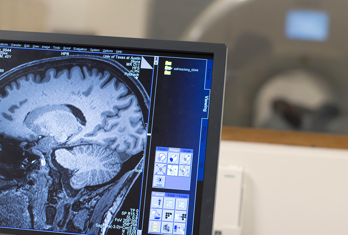 Researcher Russell Poldrack's MRI brain scan seen on a computer monitor at University of Texas at Austin.