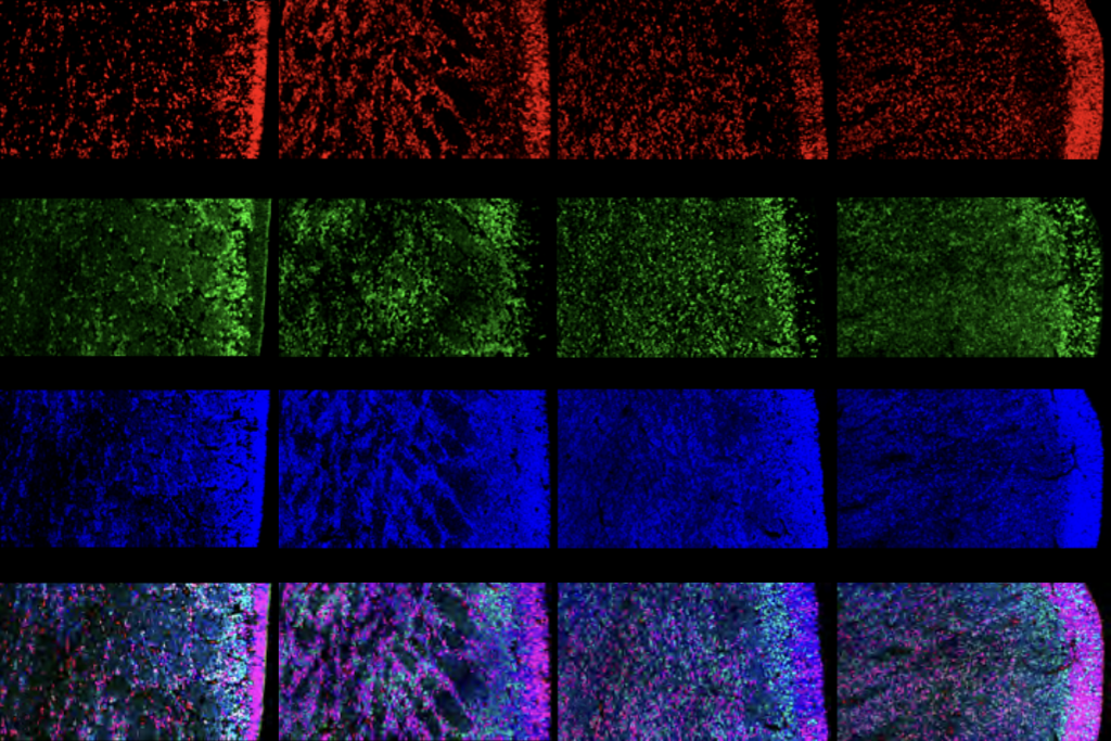 Progenitors cells in the medial ganglionic eminence become increasingly organized during development as rows of brain imaging progress from top to bottom.