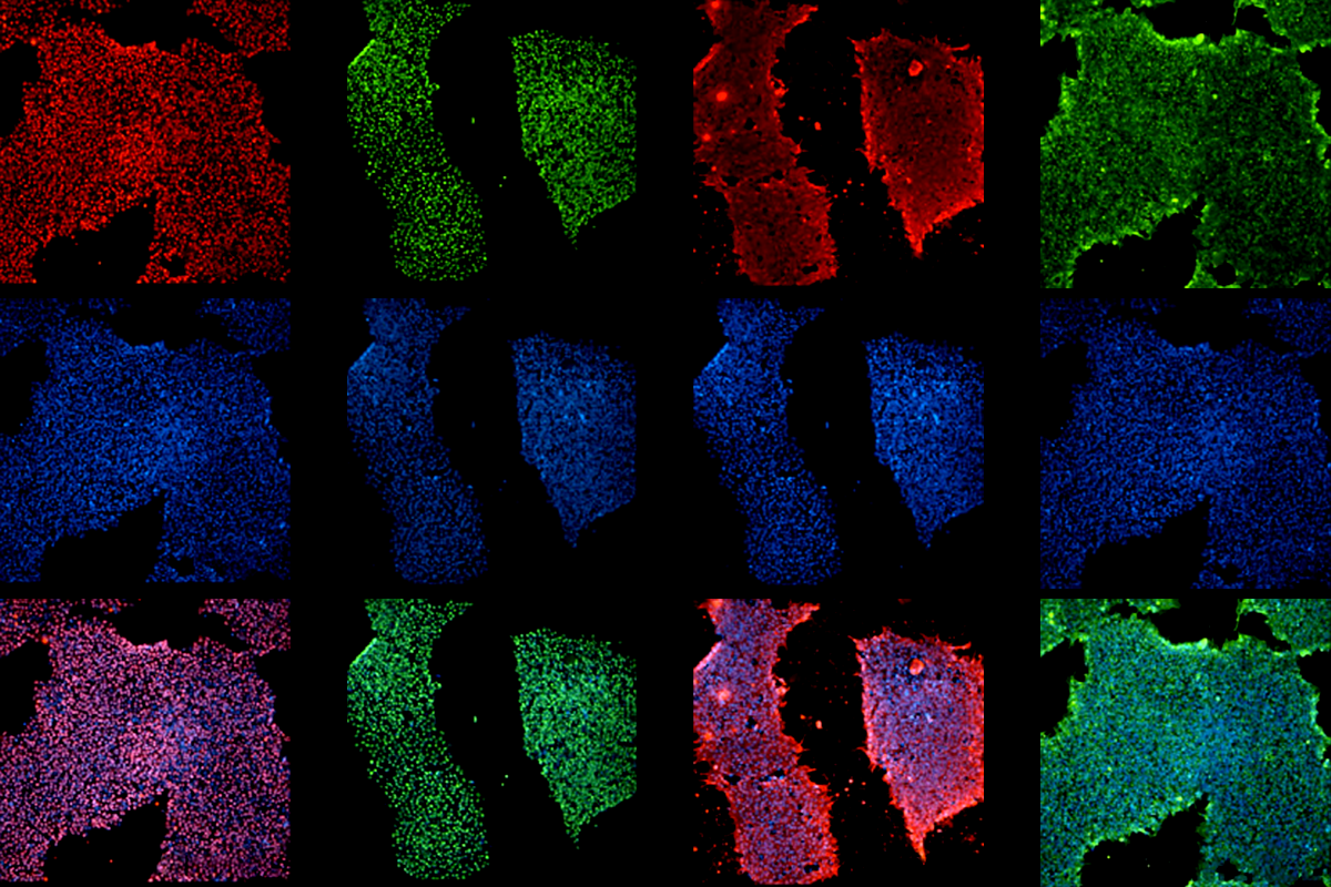 Research image of stem cells derived from people of African ancestry.