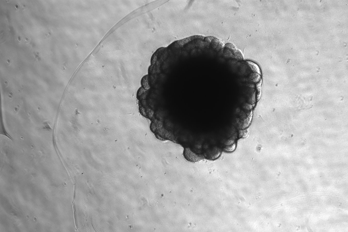 Chimpanzee neural organoid.