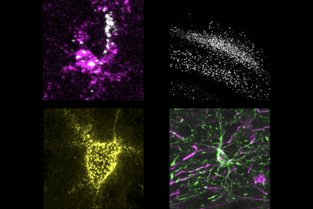 Research images of the mouse visual cortex.