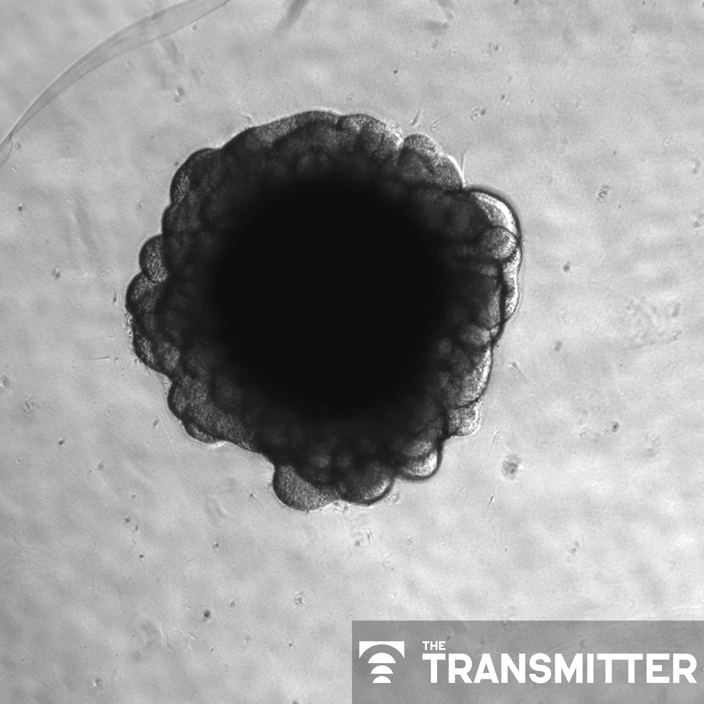 Viral remnant in chimpanzees silences brain gene humans still use episode artwork